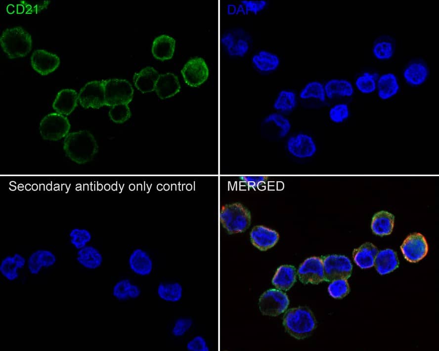 Immunocytochemistry/ Immunofluorescence: CD21 Antibody (PD00-23) [NBP3-32135] - Immunocytochemistry analysis of Raji cells labeling CD21 with Rabbit anti-CD21 antibody (NBP3-32135) at 1/100 dilution. Cells were fixed in 4% paraformaldehyde for 10 minutes at 37 ℃, permeabilized with 0.05% Triton X-100 in PBS for 20 minutes, and then blocked with 2% negative goat serum for 30 minutes at room temperature. Cells were then incubated with Rabbit anti-CD21 antibody (NBP3-32135) at 1/100 dilution in 2% negative goat serum overnight at 4 ℃. Goat Anti-Rabbit IgG H&L (iFluor™ 488) was used as the secondary antibody at 1/1,000 dilution. Nuclear DNA was labelled in blue with DAPI. Beta tubulin (red) was stained at 1/200 dilution overnight at +4℃. Goat Anti-Mouse IgG H&L (iFluor™ 594) was used as the secondary antibody at 1/1,000 dilution.