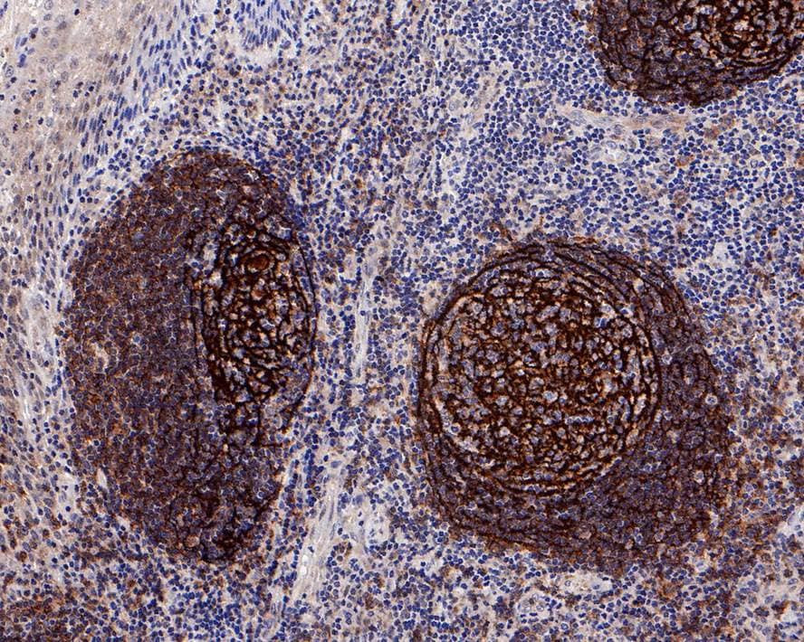 Immunohistochemistry: CD21 Antibody (PD00-23) [NBP3-32135] - Immunohistochemical analysis of paraffin-embedded human tonsil tissue with Rabbit anti-CD21 antibody (NBP3-32135) at 1/4,000 dilution. The section was pre-treated using heat mediated antigen retrieval with Tris-EDTA buffer (pH 9.0) for 20 minutes. The tissues were blocked in 1% BSA for 20 minutes at room temperature, washed with ddH2O and PBS, and then probed with the primary antibody (NBP3-32135) at 1/4,000 dilution for 1 hour at room temperature. The detection was performed using an HRP conjugated compact polymer system. DAB was used as the chromogen. Tissues were counterstained with hematoxylin and mounted with DPX.