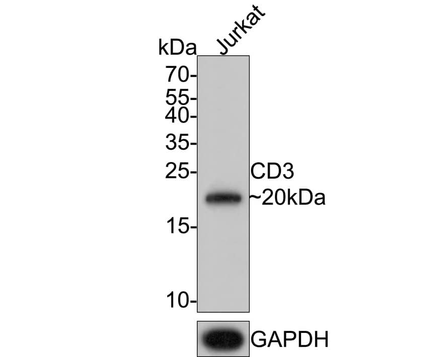 Western Blot: CD3 Antibody (PD01-43) [NBP3-32140] - Western blot analysis of CD3 on Jurkat cell lysates with Mouse anti-CD3 antibody (NBP3-32140) at 1/1,000 dilution. Lysates/proteins at 10 ug/Lane. Predicted band size: 23 kDa Observed band size: 20 kDa Exposure time: 2 minutes; 15% SDS-PAGE gel. Proteins were transferred to a PVDF membrane and blocked with 5% NFDM/TBST for 1 hour at room temperature. The primary antibody (NBP3-32140) at 1/1,000 dilution was used in 5% NFDM/TBST at room temperature for 2 hours. Goat Anti-Mouse IgG - HRP Secondary Antibody at 1:150,000 dilution was used for 1 hour at room temperature.