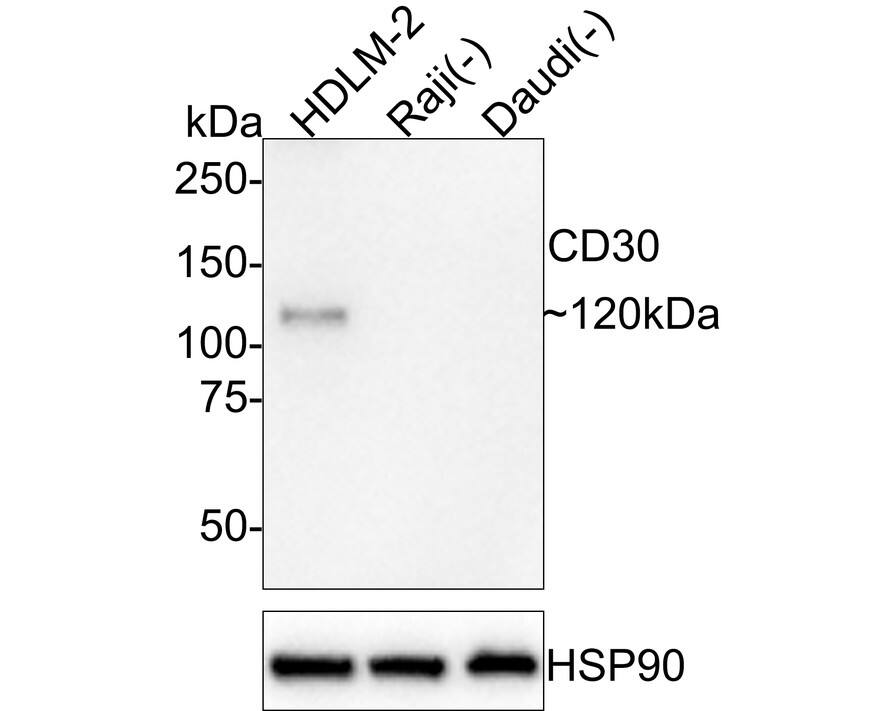 Western blot analysis on different lysates with NBP3-32141 at 1/1,000 dilution. Lane 1: HDLM-2 cell lysate Lane 2: Raji cell lysate (negative) Lane 3: Daudi cell lysate (negative) Lysates/proteins at 20 µg/Lane. Predicted band size: 64 kDa Observed band size: 120 kDa Exposure time: 5 minutes; 4-20% SDS-PAGE gel. Proteins were transferred to a PVDF membrane and blocked with 5% NFDM/TBST for 1 hour at room temperature. NBP3-32141 at 1/1,000 dilution was used in 5% NFDM/TBST at 4℃ overnight. Goat Anti-Rabbit IgG [HRP] Secondary Antibody at 1:100,000 dilution was used for 1 hour at room temperature.