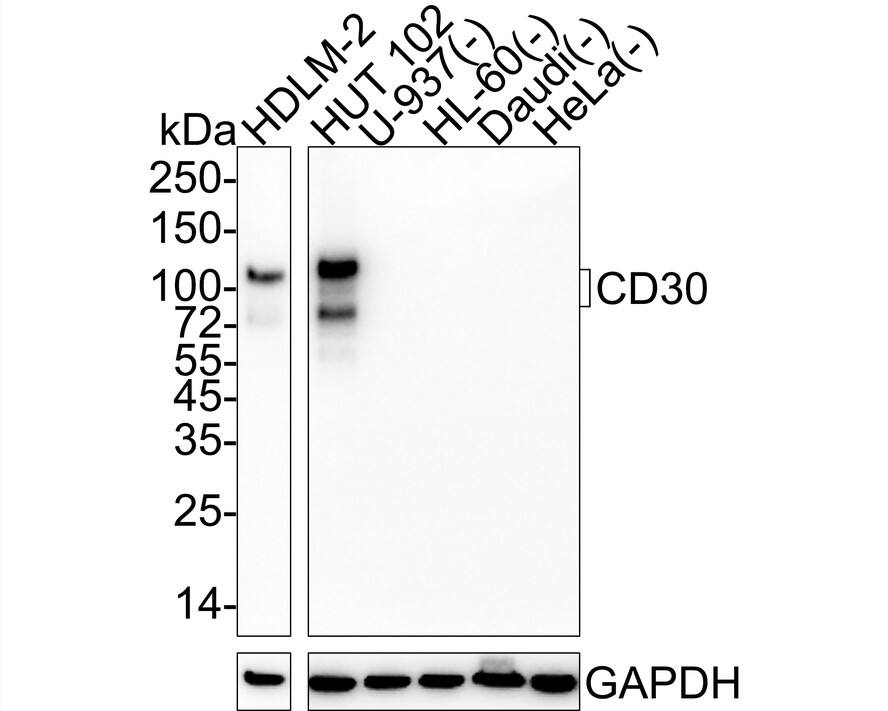 Western blot analysis on different lysates with NBP3-32142 at 1/1,000 dilution. Lane 1: HDLM-2 cell lysate Lane 2: HUT 102 cell lysate Lane 3: U-937 cell lysate (negative) Lane 4: HL-60 cell lysate (negative) Lane 5: Daudi cell lysate (negative) Lane 6: HeLa cell lysate (negative) Lysates/proteins at 20 µg/Lane. Predicted band size: 64 kDa Observed band size: 75-120 kDa Exposure time: 1 minute 2 seconds;  4-20% SDS-PAGE gel. Proteins were transferred to a PVDF membrane and blocked with 5% NFDM/TBST for 1 hour at room temperature. NBP3-32142 at 1/1,000 dilution was used in 5% NFDM/TBST at 4℃ overnight. Goat Anti-Rabbit IgG [HRP] Secondary Antibody at 1/50,000 dilution was used for 1 hour at room temperature.