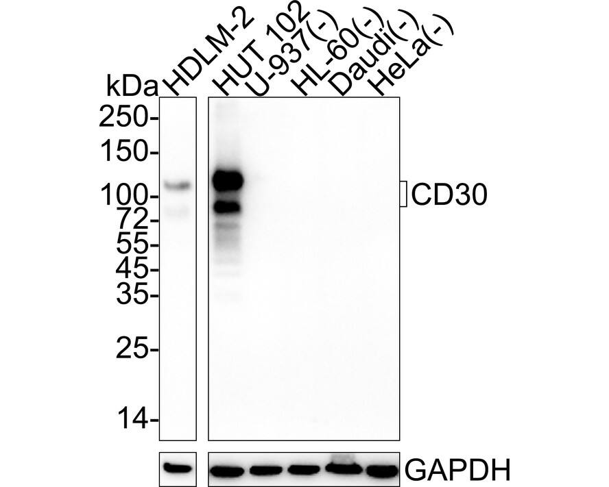 Western blot analysis on different lysates with NBP3-32143 at 1/1,000 dilution. Lane 1: HDLM-2 cell lysate Lane 2: HUT 102 cell lysate Lane 3: U-937 cell lysate (negative) Lane 4: HL-60 cell lysate (negative) Lane 5: Daudi cell lysate (negative) Lane 6: HeLa cell lysate (negative) Lysates/proteins at 20 µg/Lane. Predicted band size: 64 kDa Observed band size: 75-120 kDa Exposure time: 1 minute 2 seconds; 4-20% SDS-PAGE gel. Proteins were transferred to a PVDF membrane and blocked with 5% NFDM/TBST for 1 hour at room temperature. NBP3-32143 at 1/1,000 dilution was used in 5% NFDM/TBST at 4℃ overnight. Goat Anti-Rabbit IgG [HRP] Secondary Antibody at 1/50,000 dilution was used for 1 hour at room temperature.