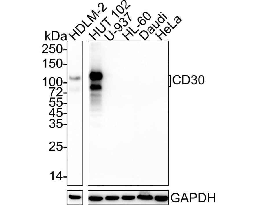 Western Blot: CD30/TNFRSF8 Antibody (PSH04-11) [NBP3-32143] - Western blot analysis of CD30/TNFRSF8 on different lysates with Rabbit anti-CD30/TNFRSF8 antibody (NBP3-32143) at 1/1,000 dilution. Lane 1: HDLM-2 cell lysate Lane 2: HUT 102 cell lysate Lane 3: U-937 cell lysate (negative) Lane 4: HL-60 cell lysate (negative) Lane 5: Daudi cell lysate (negative) Lane 6: HeLa cell lysate (negative) Lysates/proteins at 20 ug/Lane. Predicted band size: 64 kDa Observed band size: 75-120 kDa Exposure time: 1 minute 2 seconds; 4-20% SDS-PAGE gel. Proteins were transferred to a PVDF membrane and blocked with 5% NFDM/TBST for 1 hour at room temperature. The primary antibody (NBP3-32143) at 1/1,000 dilution was used in 5% NFDM/TBST at 4C overnight. Goat Anti-Rabbit IgG - HRP Secondary Antibody at 1/50,000 dilution was used for 1 hour at room temperature.