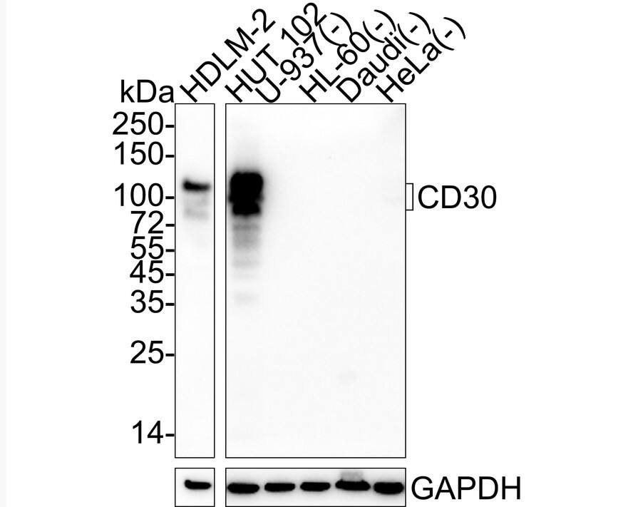 Western blot analysis on different lysates with NBP3-32144 at 1/1,000 dilution. Lane 1: HDLM-2 cell lysate Lane 2: HUT 102 cell lysate Lane 3: U-937 cell lysate (negative) Lane 4: HL-60 cell lysate (negative) Lane 5: Daudi cell lysate (negative) Lane 6: HeLa cell lysate (negative) Lysates/proteins at 20 µg/Lane. Predicted band size: 64 kDa Observed band size: 75-120 kDa Exposure time: 1 minute 2 seconds;  4-20% SDS-PAGE gel. Proteins were transferred to a PVDF membrane and blocked with 5% NFDM/TBST for 1 hour at room temperature. NBP3-32144 at 1/1,000 dilution was used in 5% NFDM/TBST at 4℃ overnight. Goat Anti-Rabbit IgG [HRP] Secondary Antibody at 1/50,000 dilution was used for 1 hour at room temperature.