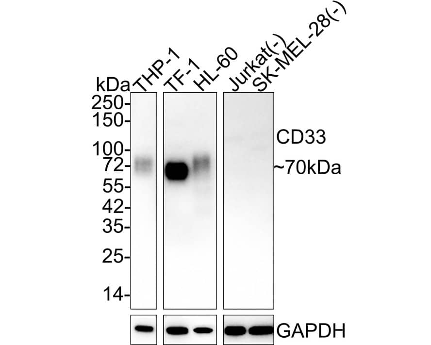 Western blot analysis on different lysates with NBP3-32146 at 1/2,000 dilution. Lane 1: THP-1 cell lysate Lane 2: TF-1 cell lysate Lane 3: HL-60 cell lysate Lane 4: Jurkat cell lysate (negative) Lane 5: SK-MEL-28 cell lysate (negative) Lysates/proteins at 20 µg/Lane. Predicted band size: 40 kDa Observed band size: 70 kDa Exposure time: 3 minutes; 4-20% SDS-PAGE gel. Proteins were transferred to a PVDF membrane and blocked with 5% NFDM/TBST for 1 hour at room temperature. NBP3-32146 at 1/2,000 dilution was used in 5% NFDM/TBST at 4℃ overnight. Goat Anti-Rabbit IgG [HRP] Secondary Antibody at 1/50,000 dilution was used for 1 hour at room temperature.