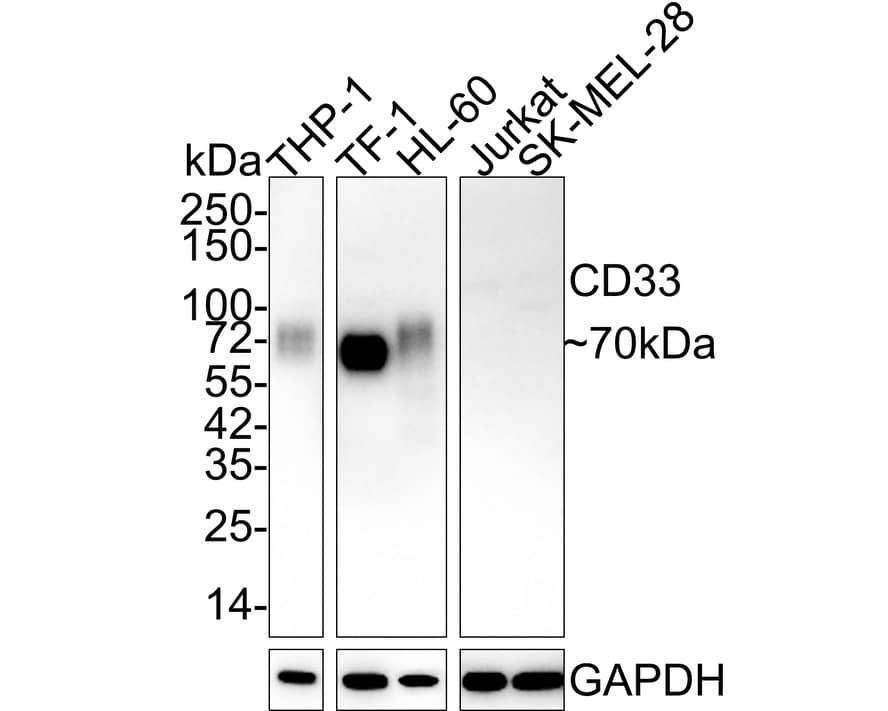 Western Blot: Siglec-3/CD33 Antibody (PSH02-50) [NBP3-32146] - Western blot analysis of Siglec-3/CD33 on different lysates with Rabbit anti-Siglec-3/CD33 antibody (NBP3-32146) at 1/2,000 dilution. Lane 1: THP-1 cell lysate Lane 2: TF-1 cell lysate Lane 3: HL-60 cell lysate Lane 4: Jurkat cell lysate (negative) Lane 5: SK-MEL-28 cell lysate (negative) Lysates/proteins at 20 ug/Lane. Predicted band size: 40 kDa Observed band size: 70 kDa Exposure time: 3 minutes; ECL; 4-20% SDS-PAGE gel. Proteins were transferred to a PVDF membrane and blocked with 5% NFDM/TBST for 1 hour at room temperature. The primary antibody (NBP3-32146) at 1/2,000 dilution was used in 5% NFDM/TBST at 4C overnight. Goat Anti-Rabbit IgG - HRP Secondary Antibody at 1/50,000 dilution was used for 1 hour at room temperature.