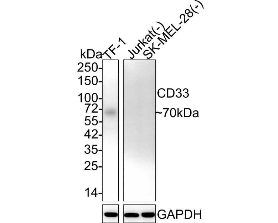 Western blot analysis on different lysates with NBP3-32147 at 1/2,000 dilution. Lane 1: TF-1 cell lysate Lane 2: Jurkat cell lysate (negative) Lane 3: SK-MEL-28 cell lysate (negative) Lysates/proteins at 20 µg/Lane. Predicted band size: 40 kDa Observed band size: 70 kDa Exposure time: 3 minutes; 4-20% SDS-PAGE gel. Proteins were transferred to a PVDF membrane and blocked with 5% NFDM/TBST for 1 hour at room temperature. NBP3-32147 at 1/2,000 dilution was used in 5% NFDM/TBST at 4℃ overnight. Goat Anti-Rabbit IgG [HRP] Secondary Antibody at 1/50,000 dilution was used for 1 hour at room temperature.