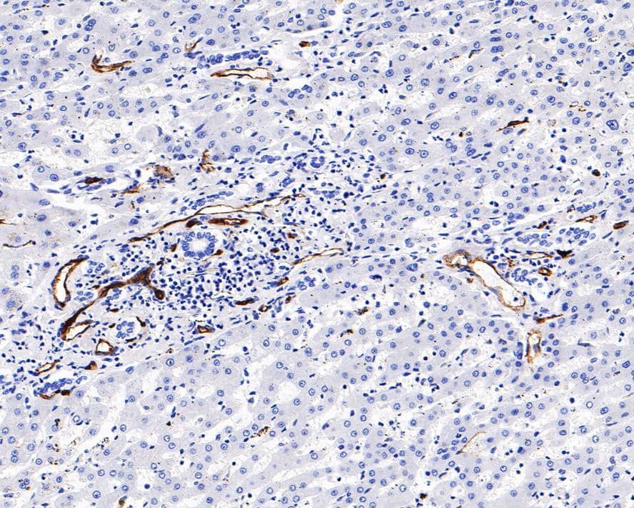 Immunohistochemistry: CD34 Antibody (PDM0-12) [NBP3-32148] - Immunohistochemical analysis of paraffin-embedded human liver tissue with Mouse anti-CD34 antibody (NBP3-32148) at 1/1,000 dilution. The section was pre-treated using heat mediated antigen retrieval with Tris-EDTA buffer (pH 9.0) for 20 minutes. The tissues were blocked in 1% BSA for 20 minutes at room temperature, washed with ddH2O and PBS, and then probed with the primary antibody (NBP3-32148) at 1/1,000 dilution for 1 hour at room temperature. The detection was performed using an HRP conjugated compact polymer system. DAB was used as the chromogen. Tissues were counterstained with hematoxylin and mounted with DPX.