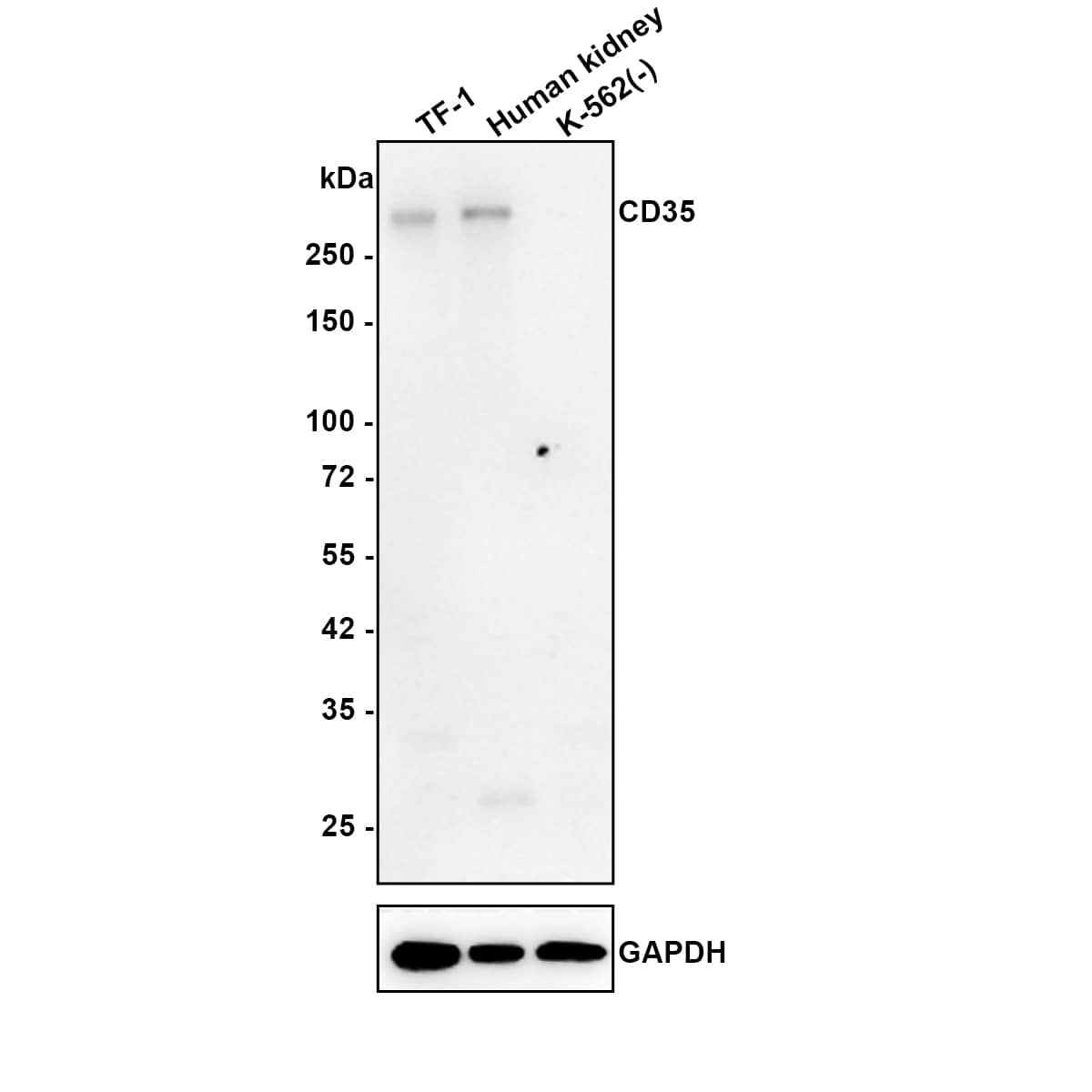 Western blot analysis on different lysates with NBP3-32149 at 1/2,000 dilution. Lane 1: TF-1 cell lysate Lane 2: Human kidney tissue lysate Lane 3: K-562 cell lysate (negative) Lysates/proteins at 20 µg/Lane. Predicted band size: 224 kDa Observed band size: 280 kDa Exposure time: 1 minute 14 seconds; 4-20% SDS-PAGE gel. Proteins were transferred to a PVDF membrane and blocked with 5% NFDM/TBST for 1 hour at room temperature. NBP3-32149 at 1/2,000 dilution was used in 5% NFDM/TBST at 4℃ overnight. Goat anti-Mouse IgG [HRP] at 1/50,000 dilution was used for 1 hour at room temperature.