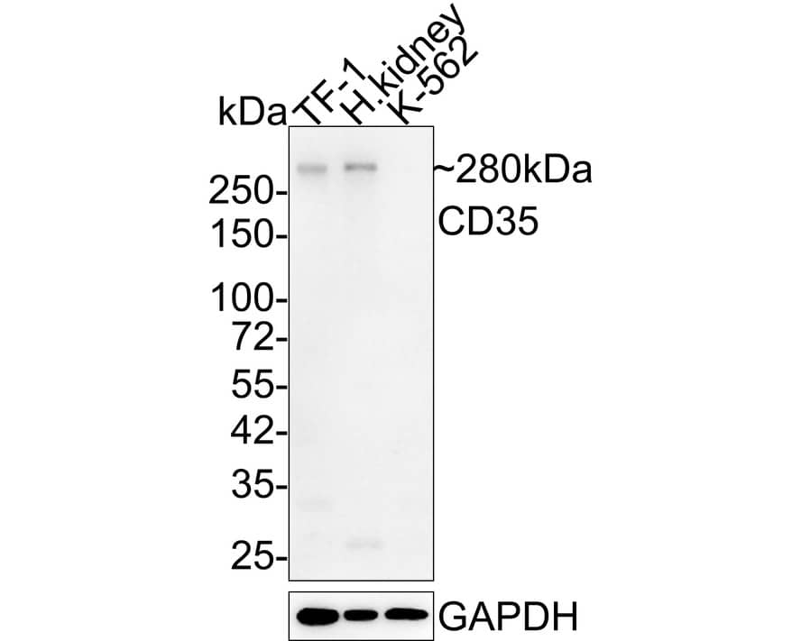 Western Blot: CD35 Antibody (A4F3-R) [NBP3-32149] - Western blot analysis of CD35 on different lysates with Mouse anti-CD35 antibody (NBP3-32149) at 1/2,000 dilution. Lane 1: TF-1 cell lysate Lane 2: Human kidney tissue lysate Lane 3: K-562 cell lysate (negative) Lysates/proteins at 20 ug/Lane. Predicted band size: 224 kDa Observed band size: 280 kDa Exposure time: 1 minute 14 seconds; 4-20% SDS-PAGE gel. Proteins were transferred to a PVDF membrane and blocked with 5% NFDM/TBST for 1 hour at room temperature. The primary antibody (NBP3-32149) at 1/2,000 dilution was used in 5% NFDM/TBST at 4C overnight. Goat Anti-Mouse IgG - HRP Secondary Antibody at 1/50,000 dilution was used for 1 hour at room temperature.