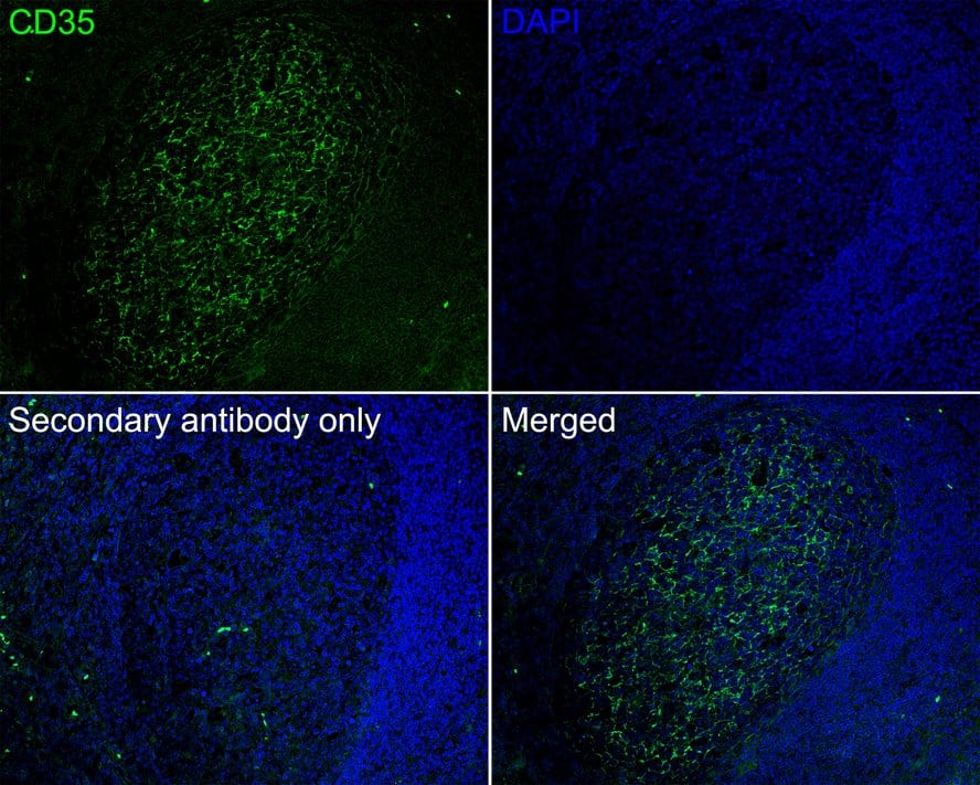 Immunohistochemistry: CD35 Antibody (A4F3-R) [NBP3-32149] - Immunofluorescence analysis of paraffin-embedded human tonsil tissue labeling CD35 with Mouse anti-CD35 antibody (NBP3-32149) at 1/200 dilution. The section was pre-treated using heat mediated antigen retrieval with Tris-EDTA buffer (pH 9.0) for 20 minutes. The tissues were blocked in 10% negative goat serum for 1 hour at room temperature, washed with PBS, and then probed with the primary antibody (NBP3-32149, green) at 1/200 dilution overnight at 4 ℃, washed with PBS. Goat Anti-Mouse IgG H&L (iFluor™ 488) was used as the secondary antibody at 1/1,000 dilution. Nuclei were counterstained with DAPI (blue).