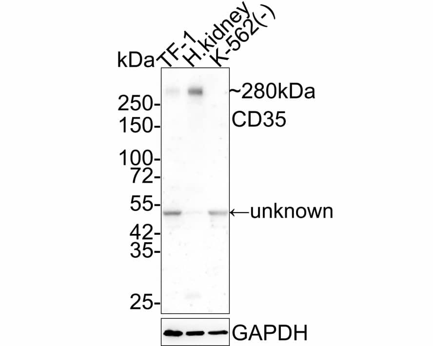 Western blot analysis on different lysates with NBP3-32150 at 1/2,000 dilution. Lane 1: TF-1 cell lysate Lane 2: Human kidney tissue lysate Lane 3: K-562 cell lysate (negative) Lysates/proteins at 20 µg/Lane. Predicted band size: 224 kDa Observed band size: 280 kDa Exposure time: 3 minutes; 4-20% SDS-PAGE gel. Proteins were transferred to a PVDF membrane and blocked with 5% NFDM/TBST for 1 hour at room temperature. NBP3-32150 at 1/2,000 dilution was used in 5% NFDM/TBST at 4℃ overnight. Goat anti-Mouse IgG [HRP] at 1/50,000 dilution was used for 1 hour at room temperature.