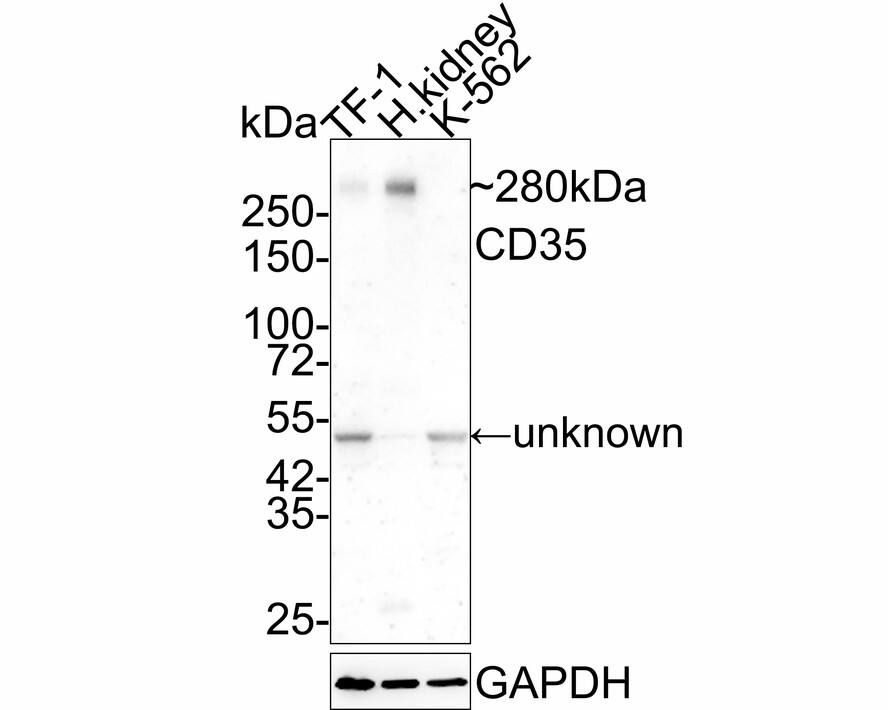 Western Blot: CD35 Antibody (A4G1-R) [NBP3-32150] - Western blot analysis of CD35 on different lysates with Mouse anti-CD35 antibody (NBP3-32150) at 1/2,000 dilution. Lane 1: TF-1 cell lysate Lane 2: Human kidney tissue lysate Lane 3: K-562 cell lysate (negative) Lysates/proteins at 20 ug/Lane. Predicted band size: 224 kDa Observed band size: 280 kDa Exposure time: 3 minutes; 4-20% SDS-PAGE gel. Proteins were transferred to a PVDF membrane and blocked with 5% NFDM/TBST for 1 hour at room temperature. The primary antibody (NBP3-32150) at 1/2,000 dilution was used in 5% NFDM/TBST at 4C overnight. Goat Anti-Mouse IgG - HRP Secondary Antibody at 1/50,000 dilution was used for 1 hour at room temperature.