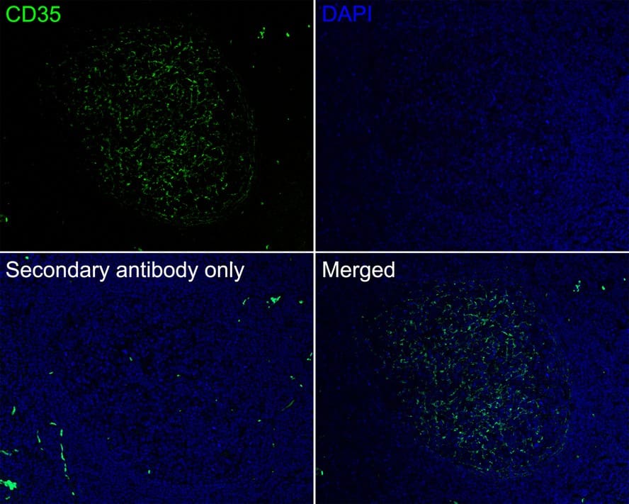 Immunohistochemistry: CD35 Antibody (A4G1-R) [NBP3-32150] - Immunofluorescence analysis of paraffin-embedded human tonsil tissue labeling CD35 with Mouse anti-CD35 antibody (NBP3-32150) at 1/200 dilution. The section was pre-treated using heat mediated antigen retrieval with Tris-EDTA buffer (pH 9.0) for 20 minutes. The tissues were blocked in 10% negative goat serum for 1 hour at room temperature, washed with PBS, and then probed with the primary antibody (NBP3-32150, green) at 1/200 dilution overnight at 4 ℃, washed with PBS. Goat Anti-Mouse IgG H&L (iFluor™ 488) was used as the secondary antibody at 1/1,000 dilution. Nuclei were counterstained with DAPI (blue).