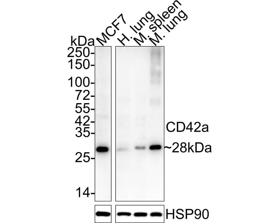 Western Blot: GP-IX Antibody (A5E6-R) [NBP3-32152] - Western blot analysis of GP-IX on different lysates with Mouse anti-GP-IX antibody (NBP3-32152) at 1/2,000 dilution. Lane 1: HeLa cell lysate Lane 2: Human lung tissue lysate Lane 3: Mouse spleen tissue lysate Lane 4: Mouse lung tissue lysate Lysates/proteins at 20 ug/Lane. Predicted band size: 19 kDa Observed band size: 28 kDa Exposure time: 1 minute 18 seconds; 4-20% SDS-PAGE gel. Proteins were transferred to a PVDF membrane and blocked with 5% NFDM/TBST for 1 hour at room temperature. The primary antibody (NBP3-32152) at 1/2,000 dilution was used in 5% NFDM/TBST at 4C overnight. Goat Anti-Mouse IgG - HRP Secondary Antibody at 1/50,000 dilution was used for 1 hour at room temperature.