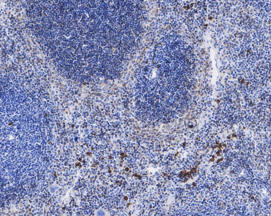 Immunohistochemistry: GP-IX Antibody (A5E6-R) [NBP3-32152] - Immunohistochemical analysis of paraffin-embedded mouse spleen tissue with Mouse anti-GP-IX antibody (NBP3-32152) at 1/2,000 dilution. The section was pre-treated using heat mediated antigen retrieval with Tris-EDTA buffer (pH 9.0) for 20 minutes. The tissues were blocked in 1% BSA for 20 minutes at room temperature, washed with ddH2O and PBS, and then probed with the primary antibody (NBP3-32152) at 1/2,000 dilution for 1 hour at room temperature. The detection was performed using an HRP conjugated compact polymer system. DAB was used as the chromogen. Tissues were counterstained with hematoxylin and mounted with DPX.