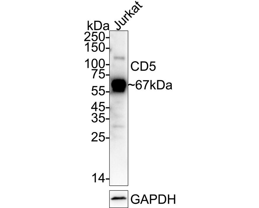 Western blot analysis of  Jurkat cell lysates with NBP3-32158 at 1/5,000 dilution. Lysates/proteins at 20 µg/Lane. Predicted band size: 55 kDa Observed band size: 67 kDa Exposure time: 1 minute;  4-20% SDS-PAGE gel. Proteins were transferred to a PVDF membrane and blocked with 5% NFDM/TBST for 1 hour at room temperature. NBP3-32158 at 1/5,000 dilution was used in primary antibody dilution at 4℃ overnight. Goat Anti-Rabbit IgG [HRP] Secondary Antibody at 1/50,000 dilution was used for 1 hour at room temperature.