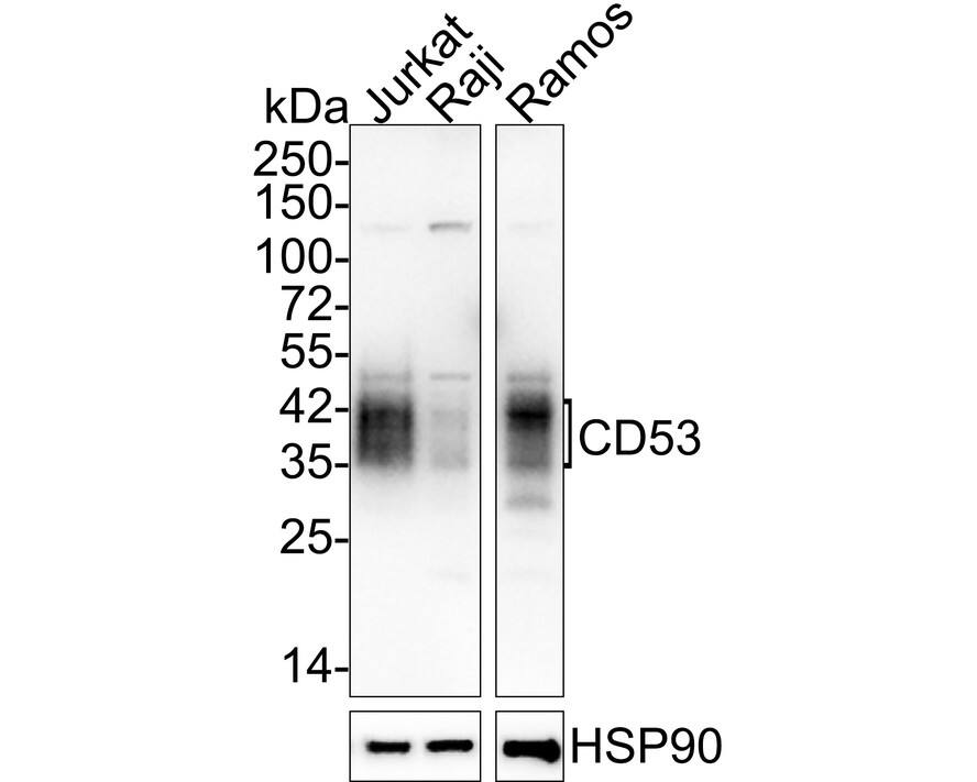 Western Blot: CD53 Antibody (JE60-38) [NBP3-32159] - Western blot analysis of CD53 on different lysates with Rabbit anti-CD53 antibody (NBP3-32159) at 1/1,000 dilution. Lane 1: Jurkat cell lysate Lane 2: Raji cell lysate Lane 3: Ramos cell lysate Lysates/proteins at 20 ug/Lane. Predicted band size: 24 kDa Observed band size: 35-42 kDa Exposure time: 1 minute 14 seconds; 4-20% SDS-PAGE gel. Proteins were transferred to a PVDF membrane and blocked with 5% NFDM/TBST for 1 hour at room temperature. The primary antibody (NBP3-32159) at 1/1,000 dilution was used in 5% NFDM/TBST at 4C overnight. Goat Anti-Rabbit IgG - HRP Secondary Antibody at 1/50,000 dilution was used for 1 hour at room temperature.