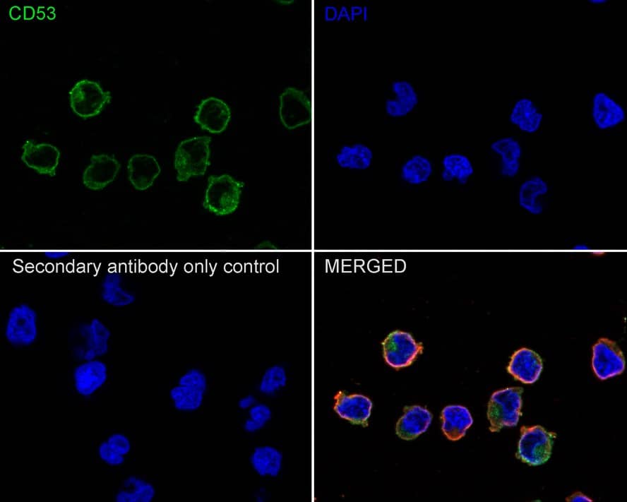 Immunocytochemistry/ Immunofluorescence: CD53 Antibody (JE60-38) [NBP3-32159] - Immunocytochemistry analysis of Jurkat cells labeling CD53 with Rabbit anti-CD53 antibody (NBP3-32159) at 1/100 dilution. Cells were fixed in 80% precooled methanol for 5 minutes at room temperature, then blocked with 1% BSA in 10% negative goat serum for 1 hour at room temperature. Cells were then incubated with Rabbit anti-CD53 antibody (NBP3-32159) at 1/100 dilution in 1% BSA in PBST overnight at 4 ℃. Goat Anti-Rabbit IgG H&L (iFluor™ 488) was used as the secondary antibody at 1/1,000 dilution. PBS instead of the primary antibody was used as the secondary antibody only control. Nuclear DNA was labelled in blue with DAPI. Beta tubulin (red) was stained at 1/100 dilution overnight at +4℃. Goat Anti-Mouse IgG H&L (iFluor™ 594) was used as the secondary antibody at 1/1,000 dilution.