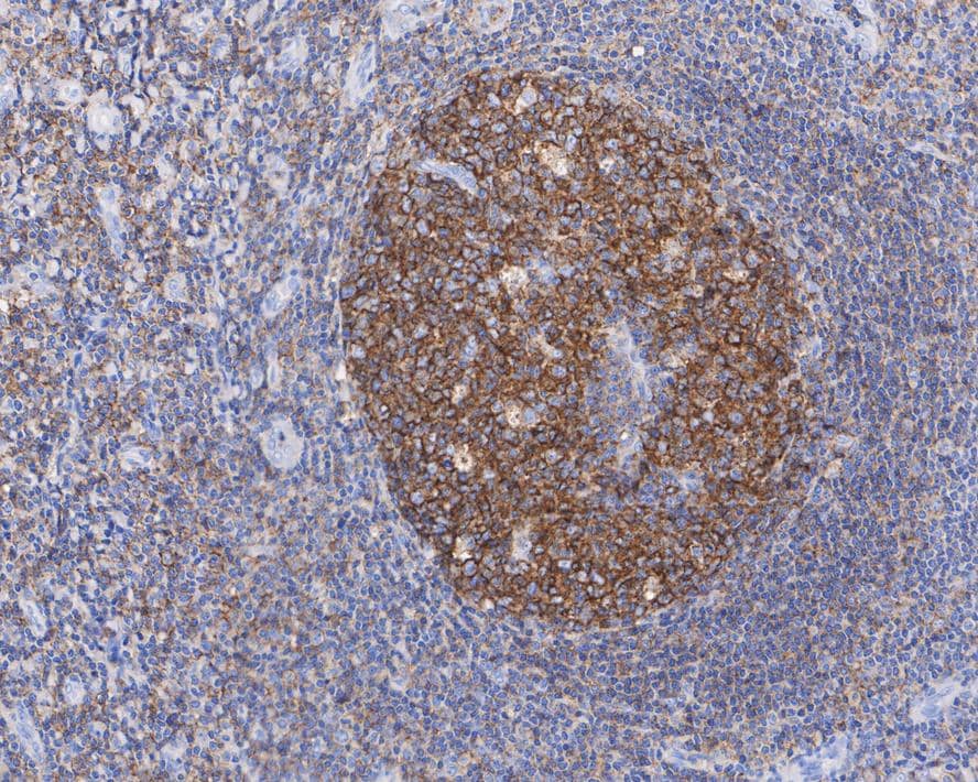 Immunohistochemistry: CD53 Antibody (JE60-38) [NBP3-32159] - Immunohistochemical analysis of paraffin-embedded human tonsil tissue with Rabbit anti-CD53 antibody (NBP3-32159) at 1/2,000 dilution. The section was pre-treated using heat mediated antigen retrieval with Tris-EDTA buffer (pH 9.0) for 20 minutes. The tissues were blocked in 1% BSA for 20 minutes at room temperature, washed with ddH2O and PBS, and then probed with the primary antibody (NBP3-32159) at 1/2,000 dilution for 1 hour at room temperature. The detection was performed using an HRP conjugated compact polymer system. DAB was used as the chromogen. Tissues were counterstained with hematoxylin and mounted with DPX.