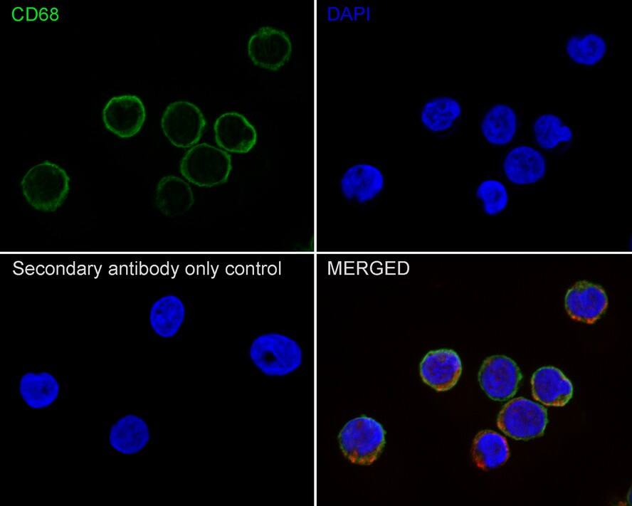 Immunocytochemistry/ Immunofluorescence: CD68/SR-D1 Antibody (PDM0-13) [NBP3-32162] - Immunocytochemistry analysis of THP-1 cells labeling CD68/SR-D1 with Mouse anti-CD68/SR-D1/SR-D1 antibody (NBP3-32162) at 1/100 dilution. Cells were fixed in 4% paraformaldehyde for 20 minutes at room temperature, permeabilized with 0.1% Triton X-100 in PBS for 5 minutes at room temperature, then blocked with 1% BSA in 10% negative goat serum for 1 hour at room temperature. Cells were then incubated with Mouse anti-CD68/SR-D1 antibody (NBP3-32162) at 1/100 dilution in 1% BSA in PBST overnight at 4 ℃. Goat Anti-Mouse IgG H&L (iFluor™ 488) was used as the secondary antibody at 1/1,000 dilution. PBS instead of the primary antibody was used as the secondary antibody only control. Nuclear DNA was labelled in blue with DAPI. beta Tubulin (red) was stained at 1/100 dilution overnight at +4℃. Goat Anti-Rabbit IgG H&L (iFluor™ 594) were used as the secondary antibody at 1/1,000 dilution.