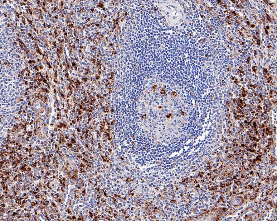 Immunohistochemistry: CD68/SR-D1 Antibody (PDM0-13) [NBP3-32162] - Immunohistochemical analysis of paraffin-embedded human spleen tissue with Mouse anti-CD68/SR-D1 antibody (NBP3-32162) at 1/200 dilution. The section was pre-treated using heat mediated antigen retrieval with Tris-EDTA buffer (pH 9.0) for 20 minutes. The tissues were blocked in 1% BSA for 20 minutes at room temperature, washed with ddH2O and PBS, and then probed with the primary antibody (NBP3-32162) at 1/200 dilution for 1 hour at room temperature. The detection was performed using an HRP conjugated compact polymer system. DAB was used as the chromogen. Tissues were counterstained with hematoxylin and mounted with DPX.