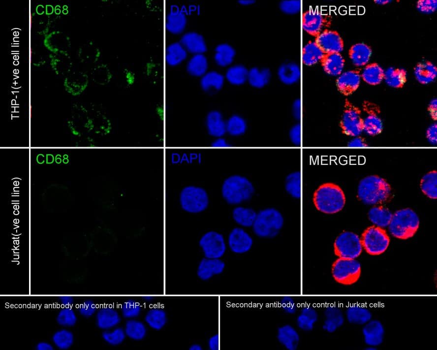 Immunocytochemistry/ Immunofluorescence: CD68/SR-D1 Antibody (A3C2-R) [NBP3-32164] - Immunocytochemistry analysis of THP-1 (positive) and Jurkat (negative) labeling CD68/SR-D1 with Mouse anti-CD68/SR-D1/SR-D1 antibody (NBP3-32164) at 1/100 dilution. Cells were fixed in 4% paraformaldehyde for 20 minutes at room temperature, permeabilized with 0.1% Triton X-100 in PBS for 5 minutes at room temperature, then blocked with 1% BSA in 10% negative goat serum for 1 hour at room temperature. Cells were then incubated with Mouse anti-CD68/SR-D1 antibody (NBP3-32164) at 1/500 dilution in 1% BSA in PBST overnight at 4 ℃. Goat Anti-Mouse IgG H&L (iFluor™ 488) was used as the secondary antibody at 1/1,000 dilution. PBS instead of the primary antibody was used as the secondary antibody only control. Nuclear DNA was labelled in blue with DAPI. beta Tubulin (red) was stained at 1/100 dilution overnight at +4℃. Goat Anti-Rabbit IgG H&L (iFluor™ 594) were used as the secondary antibody at 1/1,000 dilution.