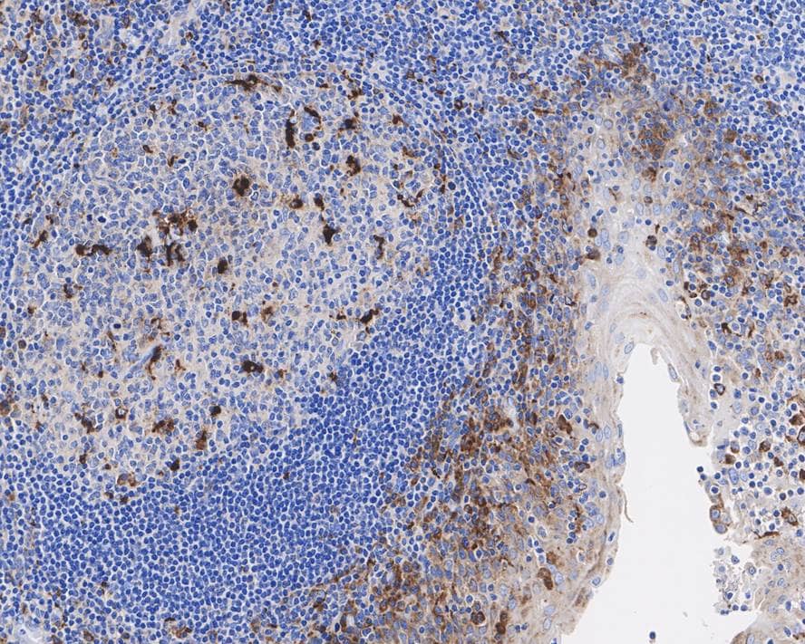 Immunohistochemistry: CD68/SR-D1 Antibody (A3C4-R) [NBP3-32165] - Immunohistochemical analysis of paraffin-embedded human tonsil tissue with Mouse anti-CD68/SR-D1 antibody (NBP3-32165) at 1/1,000 dilution. The section was pre-treated using heat mediated antigen retrieval with Tris-EDTA buffer (pH 9.0) for 20 minutes. The tissues were blocked in 1% BSA for 20 minutes at room temperature, washed with ddH2O and PBS, and then probed with the primary antibody (NBP3-32165) at 1/1,000 dilution for 1 hour at room temperature. The detection was performed using an HRP conjugated compact polymer system. DAB was used as the chromogen. Tissues were counterstained with hematoxylin and mounted with DPX.