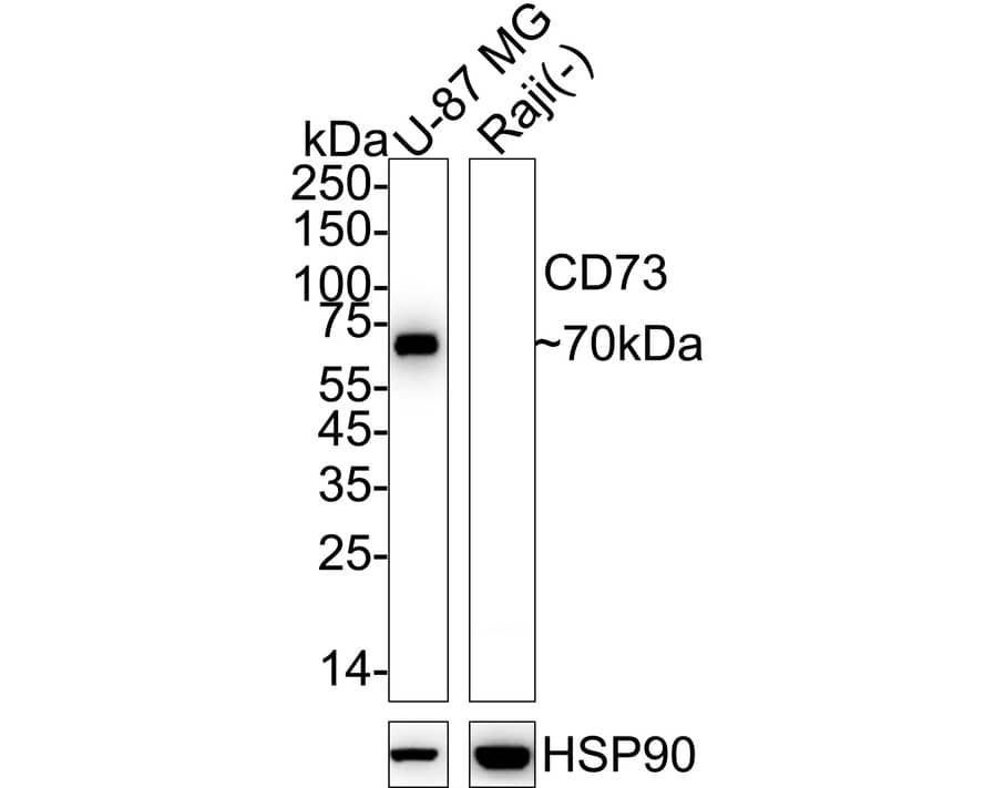 Western blot analysis on different lysates with NBP3-32166 at 1/2,000 dilution. Lane 1: U-87 MG cell lysate Lane 2: Raji cell lysate (negative) Lysates/proteins at 20 µg/Lane. Predicted band size: 63 kDa Observed band size: 70 kDa Exposure time: 9 seconds;  4-20% SDS-PAGE gel. Proteins were transferred to a PVDF membrane and blocked with 5% NFDM/TBST for 1 hour at room temperature. NBP3-32166 at 1/2,000 dilution was used in 5% NFDM/TBST at 4℃ overnight. Anti-Mouse IgG Secondary Antibody at 1/5,000 dilution was used for 1 hour at room temperature.