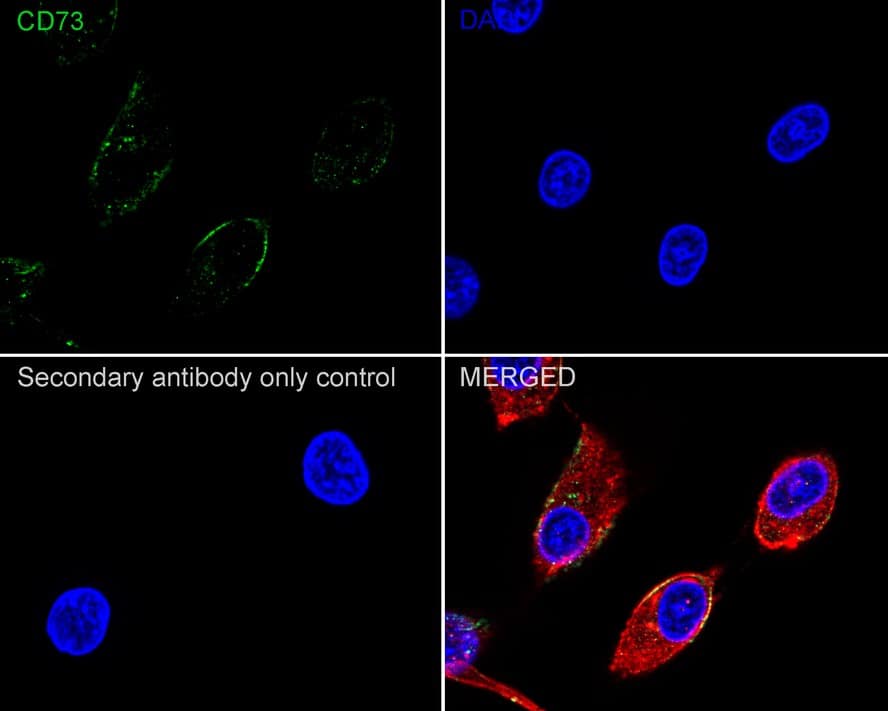 Immunocytochemistry/ Immunofluorescence: 5'-Nucleotidase/CD73 Antibody (A6G2-R) [NBP3-32166] - Immunocytochemistry analysis of U-87 MG cells labeling 5'-Nucleotidase/CD73 with Mouse anti-5'-Nucleotidase/CD73 antibody (NBP3-32166) at 1/100 dilution. Cells were fixed in 100% precooled methanol for 5 minutes at room temperature, then blocked with 1% BSA in 10% negative goat serum for 1 hour at room temperature. Cells were then incubated with Mouse anti-5'-Nucleotidase/CD73 antibody (NBP3-32166) at 1/100 dilution in 1% BSA in PBST overnight at 4 ℃. Goat Anti-Mouse IgG H&L (iFluor™ 488) was used as the secondary antibody at 1/1,000 dilution. PBS instead of the primary antibody was used as the secondary antibody only control. Nuclear DNA was labelled in blue with DAPI. beta Tubulin (red) was stained at 1/100 dilution overnight at +4℃. Goat Anti-Rabbit IgG H&L (iFluor™ 594) were used as the secondary antibody at 1/1,000 dilution.