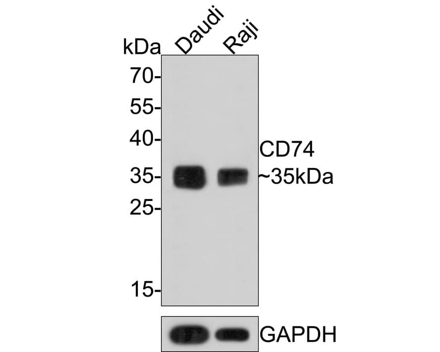 Western Blot: CD74 Antibody (PDM0-22) [NBP3-32167] - Western blot analysis of CD74 on different lysates with Mouse anti-CD74 antibody (NBP3-32167) at 1/1,000 dilution. Lane 1: Daudi cell lysate Lane 2: Raji cell lysate Lysates/proteins at 10 ug/Lane. Predicted band size: 33 kDa Observed band size: 35 kDa Exposure time: 2 minutes; 12% SDS-PAGE gel. Proteins were transferred to a PVDF membrane and blocked with 5% NFDM/TBST for 1 hour at room temperature. The primary antibody (NBP3-32167) at 1/1,000 dilution was used in 5% NFDM/TBST at room temperature for 2 hours. Goat Anti-Mouse IgG - HRP Secondary Antibody at 1:150,000 dilution was used for 1 hour at room temperature.