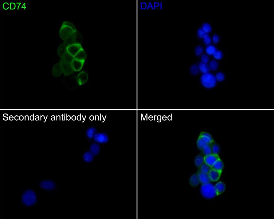 Immunocytochemistry/ Immunofluorescence: CD74 Antibody (PDM0-22) [NBP3-32167] - Immunocytochemistry analysis of LOVO cells labeling CD74 with Mouse anti-CD74 antibody (NBP3-32167) at 1/50 dilution. Cells were fixed in 4% paraformaldehyde for 30 minutes, permeabilized with 0.1% Triton X-100 in PBS for 15 minutes, and then blocked with 2% BSA for 30 minutes at room temperature. Cells were then incubated with Mouse anti-CD74 antibody (NBP3-32167) at 1/50 dilution in 2% BSA overnight at 4 ℃. Goat Anti-Mouse IgG H&L (iFluor™ 488) was used as the secondary antibody at 1/1,000 dilution. PBS instead of the primary antibody was used as the secondary antibody only control. Nuclear DNA was labelled in blue with DAPI.