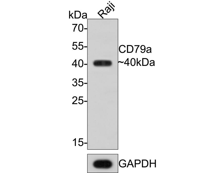 Western Blot: CD79A Antibody (PDM0-23) [NBP3-32168] - Western blot analysis of CD79A on Raji cell lysates with Mouse anti-CD79A antibody (NBP3-32168) at 1/1,000 dilution. Lysates/proteins at 10 ug/Lane. Predicted band size: 25 kDa Observed band size: 40 kDa Exposure time: 2 minutes; 12% SDS-PAGE gel. Proteins were transferred to a PVDF membrane and blocked with 5% NFDM/TBST for 1 hour at room temperature. The primary antibody (NBP3-32168) at 1/1,000 dilution was used in 5% NFDM/TBST at room temperature for 2 hours. Goat Anti-Mouse IgG - HRP Secondary Antibody at 1:150,000 dilution was used for 1 hour at room temperature.