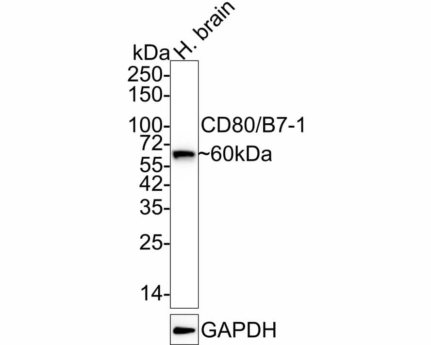 Western blot analysis of  human brain tissue lysates with NBP3-32169 at 1/1,000 dilution. Lysates/proteins at 40 µg/Lane. Predicted band size: 33 kDa Observed band size: 60 kDa Exposure time: 24 seconds; 4-20% SDS-PAGE gel. Proteins were transferred to a PVDF membrane and blocked with 5% NFDM/TBST for 1 hour at room temperature. NBP3-32169 at 1/1,000 dilution was used in 5% NFDM/TBST at 4℃ overnight. Goat anti-Mouse IgG [HRP] at 1/50,000 dilution was used for 1 hour at room temperature.