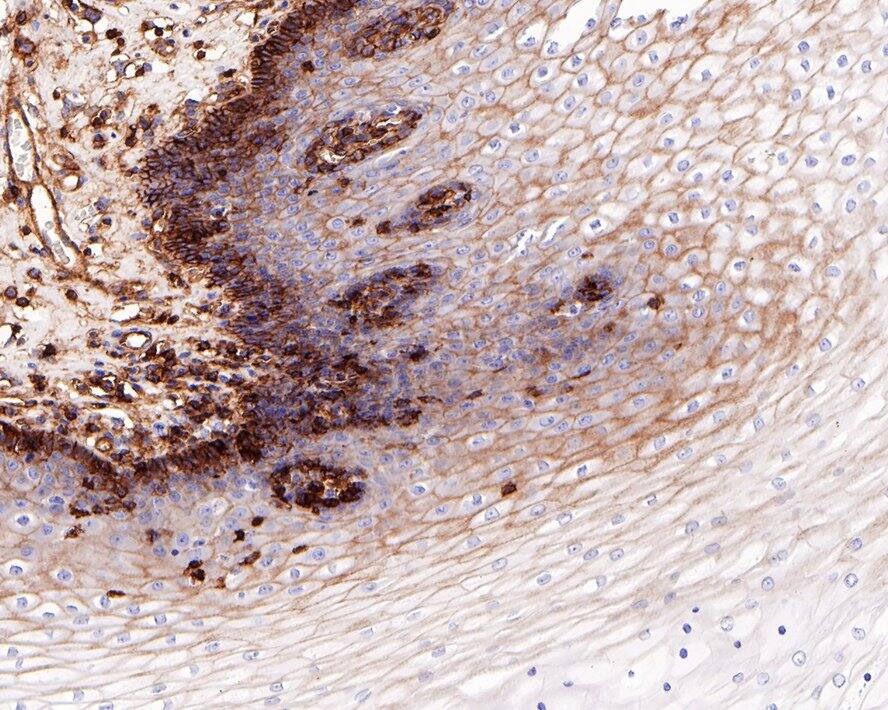 Immunohistochemistry: CD99 Antibody (PD00-13) [NBP3-32172] - Immunohistochemical analysis of paraffin-embedded human esophagus tissue with Rabbit anti-CD99 antibody (NBP3-32172) at 1/1,000 dilution. The section was pre-treated using heat mediated antigen retrieval with Tris-EDTA buffer (pH 9.0) for 20 minutes. The tissues were blocked in 1% BSA for 20 minutes at room temperature, washed with ddH2O and PBS, and then probed with the primary antibody (NBP3-32172) at 1/1,000 dilution for 1 hour at room temperature. The detection was performed using an HRP conjugated compact polymer system. DAB was used as the chromogen. Tissues were counterstained with hematoxylin and mounted with DPX.