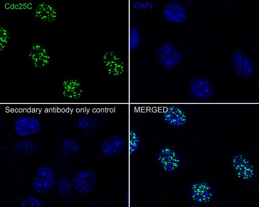 Immunocytochemistry/ Immunofluorescence: CDC25C Antibody (JE59-53) [NBP3-32173] - Immunocytochemistry analysis of HeLa cells labeling CDC25C with Rabbit anti-CDC25C antibody (NBP3-32173) at 1/100 dilution. Cells were fixed in 100% precooled methanol for 5 minutes at room temperature, then blocked with 1% BSA in 10% negative goat serum for 1 hour at room temperature. Cells were then incubated with Rabbit anti-CDC25C antibody (NBP3-32173) at 1/100 dilution in 1% BSA in PBST overnight at 4 ℃. Goat Anti-Rabbit IgG H&L (iFluor™ 488) was used as the secondary antibody at 1/1,000 dilution. PBS instead of the primary antibody was used as the secondary antibody only control. Nuclear DNA was labelled in blue with DAPI.