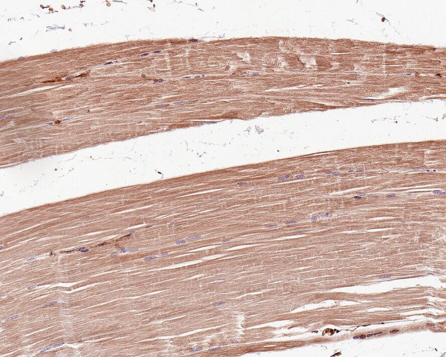 Immunohistochemistry: Cdc6 [p Ser54] Antibody (JE59-52) [NBP3-32174] - Immunohistochemical analysis of paraffin-embedded human striated muscle tissue with Rabbit anti-Cdc6 antibody (NBP3-32174) at 1/200 dilution. The section was pre-treated using heat mediated antigen retrieval with Tris-EDTA buffer (pH 9.0) for 20 minutes. The tissues were blocked in 1% BSA for 20 minutes at room temperature, washed with ddH2O and PBS, and then probed with the primary antibody (NBP3-32174) at 1/200 dilution for 1 hour at room temperature. The detection was performed using an HRP conjugated compact polymer system. DAB was used as the chromogen. Tissues were counterstained with hematoxylin and mounted with DPX.