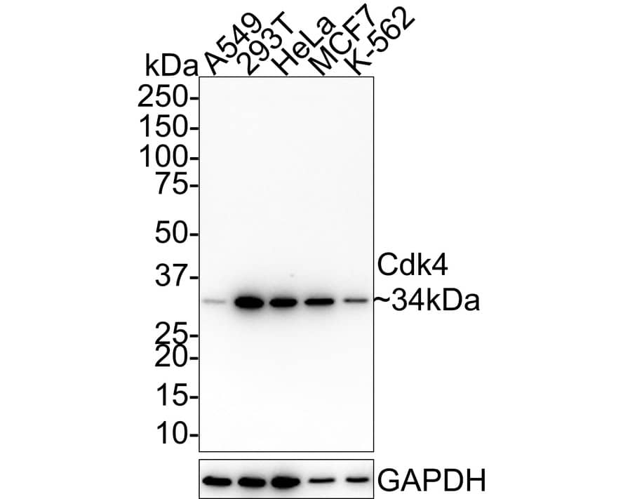 Western Blot: CDK4 Antibody (5-C3-G3-R) [NBP3-32175] - Western blot analysis of CDK4 on different lysates with Mouse anti-CDK4 antibody (NBP3-32175) at 1/1,000 dilution. Lane 1: A549 cell lysate Lane 2: 293T cell lysate Lane 3: HeLa cell lysate Lane 4: MCF7 cell lysate Lane 5: K-562 cell lysate Lysates/proteins at 20 ug/Lane. Predicted band size: 34 kDa Observed band size: 34 kDa Exposure time: 17 seconds; 4-20% SDS-PAGE gel. Proteins were transferred to a PVDF membrane and blocked with 5% NFDM/TBST for 1 hour at room temperature. The primary antibody (NBP3-32175) at 1/1,000 dilution was used in 5% NFDM/TBST at 4C overnight. Goat Anti-Mouse IgG - HRP Secondary Antibody at 1/50,000 dilution was used for 1 hour at room temperature.