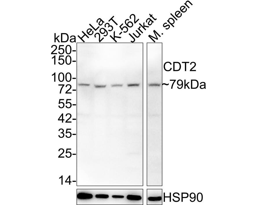 Western Blot: CDT2 Antibody (JE58-01) [NBP3-32176] - Western blot analysis of CDT2 on different lysates with Rabbit anti-CDT2 antibody (NBP3-32176) at 1/2,000 dilution. Lane 1: HeLa cell lysate (20 ug/Lane) Lane 2: 293T cell lysate (20 ug/Lane) Lane 3: K-562 cell lysate (20 ug/Lane) Lane 4: Jurkat cell lysate (20 ug/Lane) Lane 5: Mouse spleen tissue lysate (40 ug/Lane) Predicted band size: 79 kDa Observed band size: 79 kDa Exposure time: 2 minutes; 4-20% SDS-PAGE gel. Proteins were transferred to a PVDF membrane and blocked with 5% NFDM/TBST for 1 hour at room temperature. The primary antibody (NBP3-32176) at 1/2,000 dilution was used in 5% NFDM/TBST at 4C overnight. Goat Anti-Rabbit IgG - HRP Secondary Antibody at 1/50,000 dilution was used for 1 hour at room temperature.