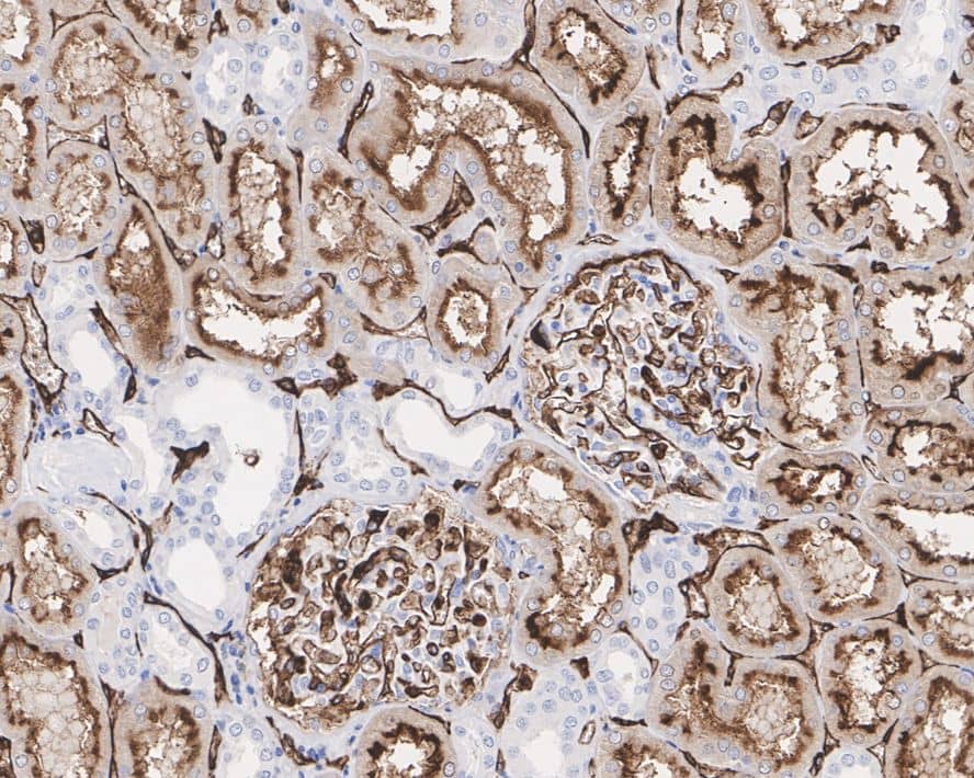 Immunohistochemistry: CEACAM1/CD66a Antibody (PSH0-78) [NBP3-32177] - Immunohistochemical analysis of paraffin-embedded human kidney tissue with Rabbit anti-CEACAM1/CD66a antibody (NBP3-32177) at 1/1,000 dilution. The section was pre-treated using heat mediated antigen retrieval with Tris-EDTA buffer (pH 9.0) for 20 minutes. The tissues were blocked in 1% BSA for 20 minutes at room temperature, washed with ddH2O and PBS, and then probed with the primary antibody (NBP3-32177) at 1/1,000 dilution for 1 hour at room temperature. The detection was performed using an HRP conjugated compact polymer system. DAB was used as the chromogen. Tissues were counterstained with hematoxylin and mounted with DPX.