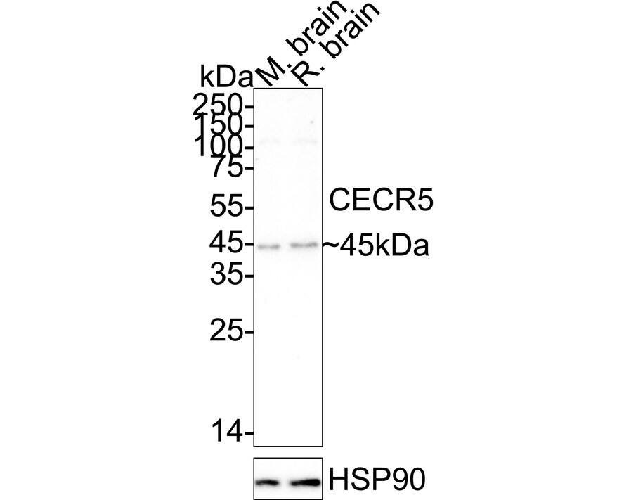 Western Blot CECR5 Antibody (JE64-76)