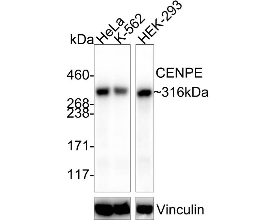 Western blot analysis on different lysates with NBP3-32180 at 1/1,000 dilution. Lane 1: HeLa cell lysate Lane 2: K-562 cell lysate Lane 3: HEK-293 cell lysate Lysates/proteins at 20 µg/Lane. Predicted band size: 316 kDa Observed band size: 316 kDa Exposure time: 43 seconds; 3-8% SDS-PAGE gel. Proteins were transferred to a PVDF membrane and blocked with 5% NFDM/TBST for 1 hour at room temperature. NBP3-32180 at 1/1,000 dilution was used in 5% NFDM/TBST at 4℃ overnight. Goat Anti-Rabbit IgG [HRP] Secondary Antibody at 1/50,000 dilution was used for 1 hour at room temperature.