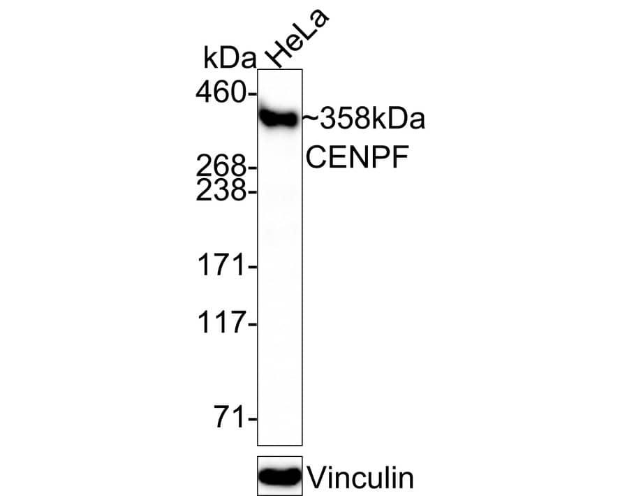 Western blot analysis of  HeLa cell lysates with NBP3-32181 at 1/1,000 dilution. Lysates/proteins at 20 µg/Lane. Predicted band size: 358 kDa Observed band size: 358 kDa Exposure time: 2 minutes; 3-8% SDS-PAGE gel. Proteins were transferred to a PVDF membrane and blocked with 5% NFDM/TBST for 1 hour at room temperature. NBP3-32181 at 1/1,000 dilution was used in 5% NFDM/TBST at room temperature for 2 hours. Goat Anti-Rabbit IgG [HRP] Secondary Antibody at 1:100,000 dilution was used for 1 hour at room temperature.