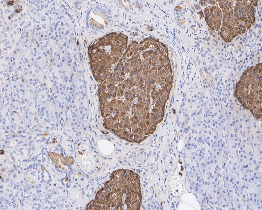 Immunohistochemistry: Chromogranin A Antibody (PD01-39) [NBP3-32184] - Immunohistochemical analysis of paraffin-embedded human pancreas tissue with Mouse anti-Chromogranin A antibody (NBP3-32184) at 1/15,000 dilution. The section was pre-treated using heat mediated antigen retrieval with Tris-EDTA buffer (pH 9.0) for 20 minutes. The tissues were blocked in 1% BSA for 20 minutes at room temperature, washed with ddH2O and PBS, and then probed with the primary antibody (NBP3-32184) at 1/15,000 dilution for 1 hour at room temperature. The detection was performed using an HRP conjugated compact polymer system. DAB was used as the chromogen. Tissues were counterstained with hematoxylin and mounted with DPX.