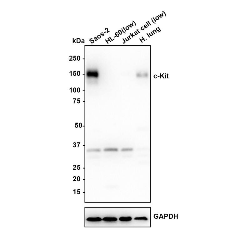 Western blot analysis on different lysates with NBP3-32188 at 1/1,000 dilution. Lane 1: Saos-2 cell lysate Lane 2: HL-60 cell lysate (low expression) Lane 3: Jurkat cell lysate (low expression) Lane 4: Human lung tissue lysate Lysates/proteins at 20 µg/Lane. Predicted band size: 110 kDa Observed band size: 150 kDa Exposure time: 2 minutes; 4-20% SDS-PAGE gel. Proteins were transferred to a PVDF membrane and blocked with 5% NFDM/TBST for 1 hour at room temperature. NBP3-32188 at 1/1,000 dilution was used in 5% NFDM/TBST at 4℃ overnight. Goat Anti-Rabbit IgG [HRP] Secondary Antibody at 1:100,000 dilution was used for 1 hour at room temperature.