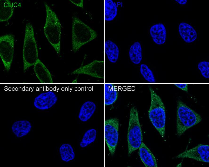 Immunocytochemistry/ Immunofluorescence: CLIC4 Antibody (JE65-09) [NBP3-32192] - Immunocytochemistry analysis of HeLa cells labeling CLIC4 with Rabbit anti-CLIC4 antibody (NBP3-32192) at 1/200 dilution. Cells were fixed in 4% paraformaldehyde for 20 minutes at room temperature, permeabilized with 0.1% Triton X-100 in PBS for 5 minutes at room temperature, then blocked with 1% BSA in 10% negative goat serum for 1 hour at room temperature. Cells were then incubated with Rabbit anti-CLIC4 antibody (NBP3-32192) at 1/200 dilution in 1% BSA in PBST overnight at 4 ℃. Goat Anti-Rabbit IgG H&L (iFluor™ 488) was used as the secondary antibody at 1/1,000 dilution. PBS instead of the primary antibody was used as the secondary antibody only control. Nuclear DNA was labelled in blue with DAPI.