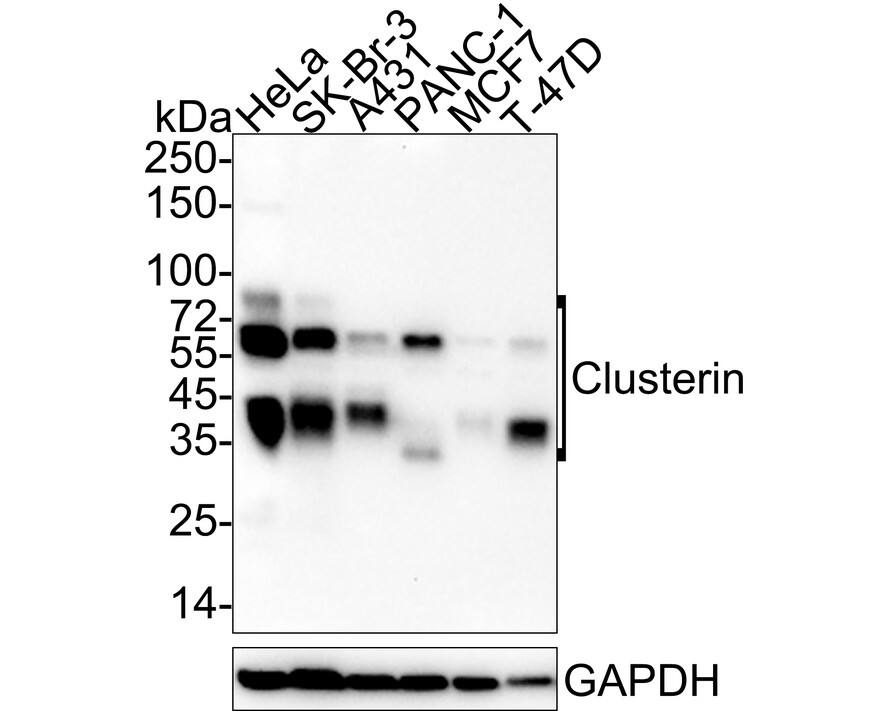 Western blot analysis on different lysates with NBP3-32196 at 1/2,000 dilution. Lane 1: HeLa cell lysate (20 µg/Lane) Lane 2: SK-Br-3 cell lysate (20 µg/Lane) Lane 3: A431 cell lysate (20 µg/Lane) Lane 4: PANC-1 cell lysate (20 µg/Lane) Lane 5: MCF7 cell lysate (20 µg/Lane) Lane 6: T-47D cell lysate (20 µg/Lane) Predicted band size: 52 kDa Observed band size: 35-80 kDa Exposure time: 1 minute 50 seconds;  4-20% SDS-PAGE gel. Proteins were transferred to a PVDF membrane and blocked with 5% NFDM/TBST for 1 hour at room temperature. NBP3-32196 at 1/2,000 dilution was used in 5% NFDM/TBST at 4℃ overnight. Goat Anti-Rabbit IgG [HRP] Secondary Antibody at 1/50,000 dilution was used for 1 hour at room temperature.