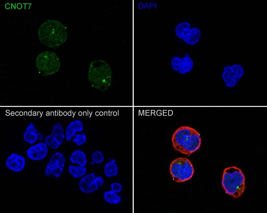 Immunocytochemistry/ Immunofluorescence: CNOT7 Antibody (PSH02-81) [NBP3-32202] - Immunocytochemistry analysis of F9 cells labeling CNOT7 with Rabbit anti-CNOT7 antibody (NBP3-32202) at 1/200 dilution. Cells were fixed in 4% paraformaldehyde for 20 minutes at room temperature, permeabilized with 0.1% Triton X-100 in PBS for 5 minutes at room temperature, then blocked with 1% BSA in 10% negative goat serum for 1 hour at room temperature. Cells were then incubated with Rabbit anti-CNOT7 antibody (NBP3-32202) at 1/200 dilution in 1% BSA in PBST overnight at 4 ℃. Goat Anti-Rabbit IgG H&L (iFluor™ 488) was used as the secondary antibody at 1/1,000 dilution. PBS instead of the primary antibody was used as the secondary antibody only control. Nuclear DNA was labelled in blue with DAPI. Beta tubulin (red) was stained at 1/100 dilution overnight at +4℃. Goat Anti-Mouse IgG H&L (iFluor™ 594) was used as the secondary antibody at 1/1,000 dilution.