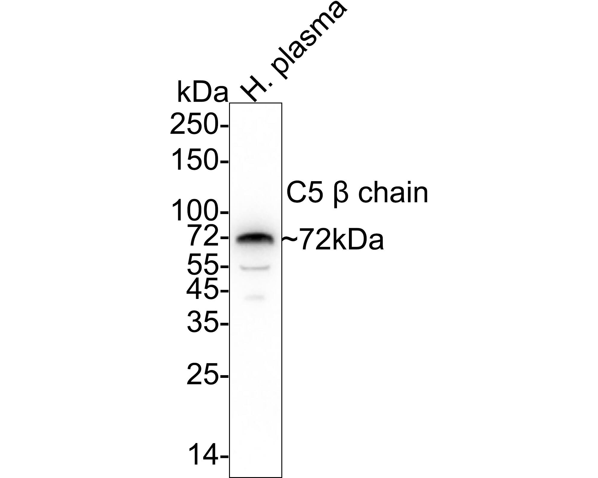 Western Blot Complement C5 Antibody (PSH04-01)