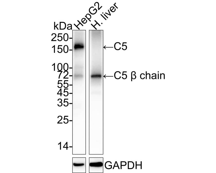 Western Blot: Complement C5 Antibody (PSH04-01) [NBP3-32209] - Western blot analysis of Complement C5 on different lysates with Rabbit anti-Complement C5 antibody (NBP3-32209) at 1/2,000 dilution. Lane 1: HepG2 cell lysate (20 ug/Lane) Lane 2: Human liver tissue lysate (40 ug/Lane) Predicted band size: 188 kDa Observed band size: 188/72 kDa Exposure time: 43 seconds; ECL 4-20% SDS-PAGE gel. Proteins were transferred to a PVDF membrane and blocked with 5% NFDM/TBST for 1 hour at room temperature. The primary antibody (NBP3-32209) at 1/2,000 dilution was used in 5% NFDM/TBST at 4C overnight. Goat Anti-Rabbit IgG - HRP Secondary Antibody at 1/50,000 dilution was used for 1 hour at room temperature.